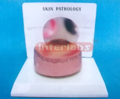 DESK-TYPE COMMON PATHOLOGIES MODEL OF ERUPTION SERIES WITH DESCRIPTION PLATE